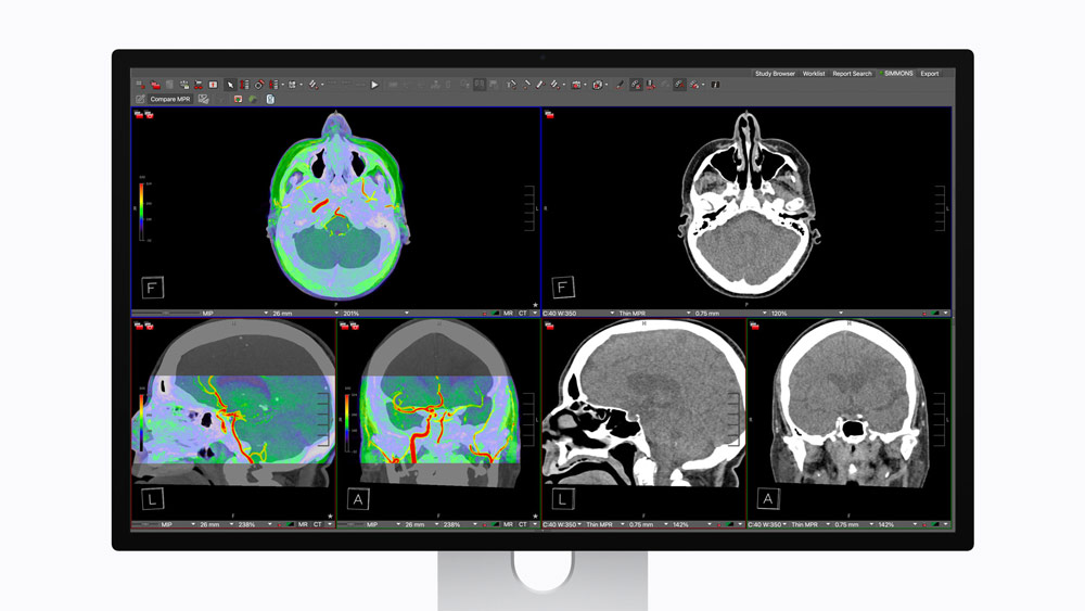 With the new medical imaging reference modes and DICOM calibration app, Studio Display XDR can be used to review medical images with outstanding grayscale and color accuracy. And it can easily be switched back to a default preset for general use.